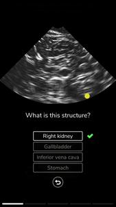 Deepscope Ultrasound Simulator