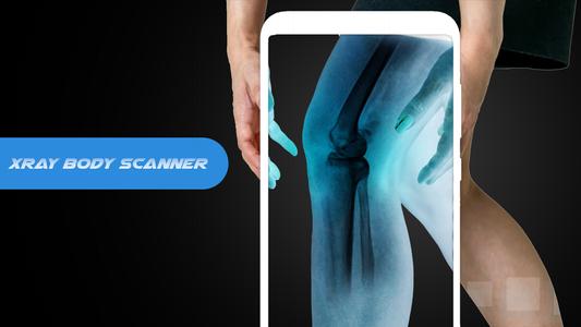 X ray Body Scanner Xray camera