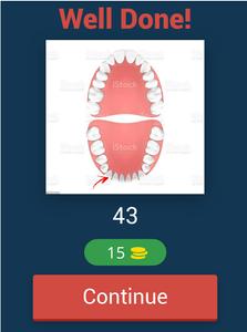 Tooth Numbering Quiz