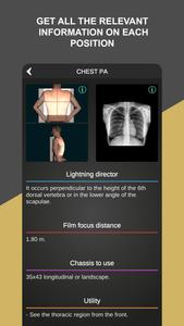 RX - Radiographic Positioning