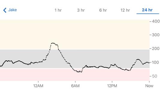 Dexcom Follow