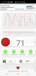 Cardiac diagnosis-heart rate