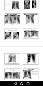 Medical X-Ray Interpretation w