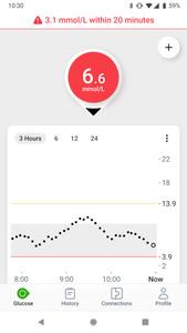 Dexcom G7