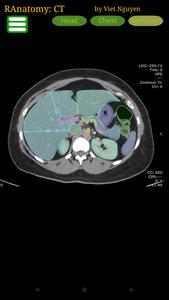 Radiology CT Anatomy