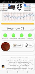 Cardiac diagnosis-heart rate