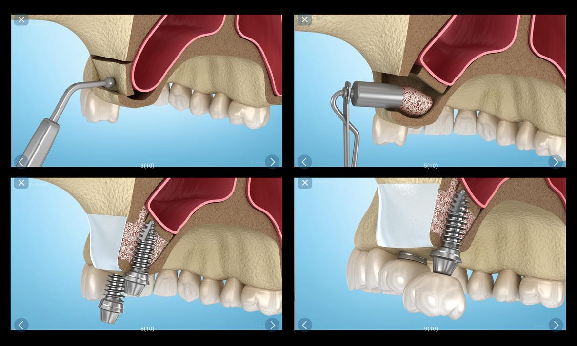 Dental 3D Illustrations