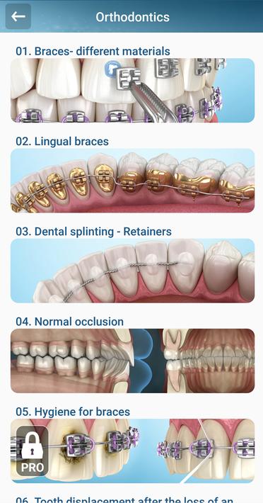 Dental 3D Illustrations