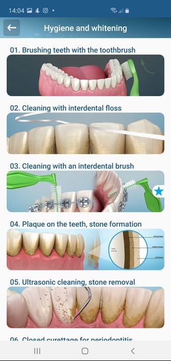 Dental 3D Illustrations