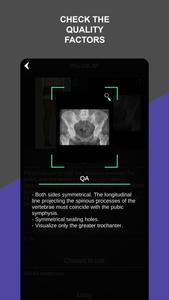 RX - Radiographic Positioning