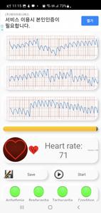 Cardiac diagnosis-heart rate