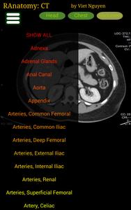 Radiology CT Anatomy