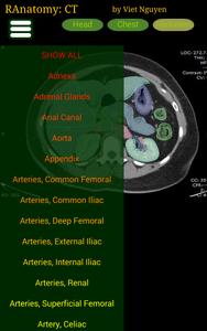 Radiology CT Anatomy