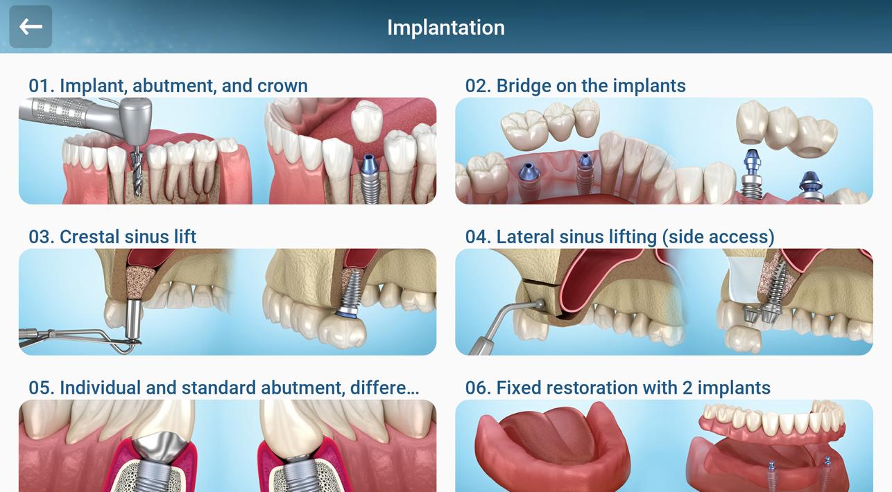 Dental 3D Illustrations