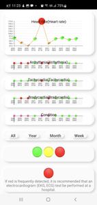 Cardiac diagnosis-heart rate