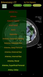 Radiology CT Anatomy