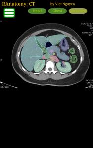 Radiology CT Anatomy