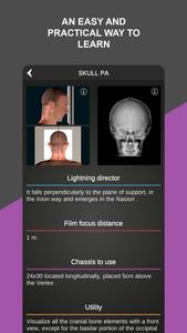 RX - Radiographic Positioning