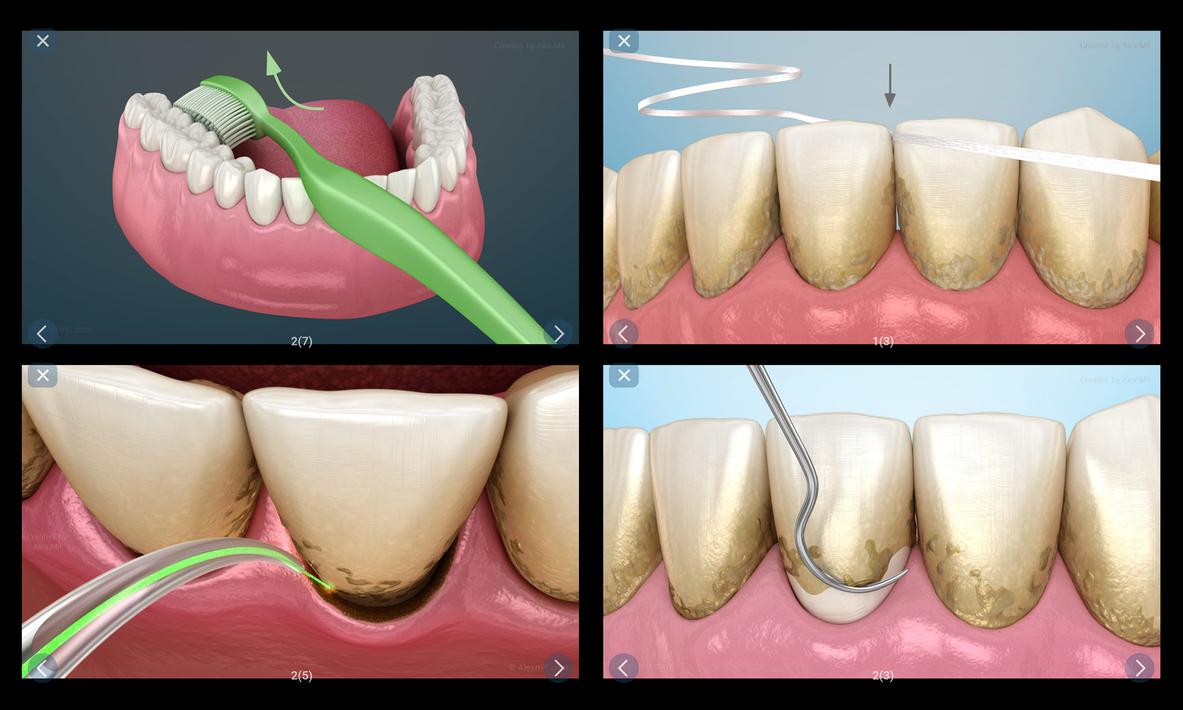 Dental 3D Illustrations