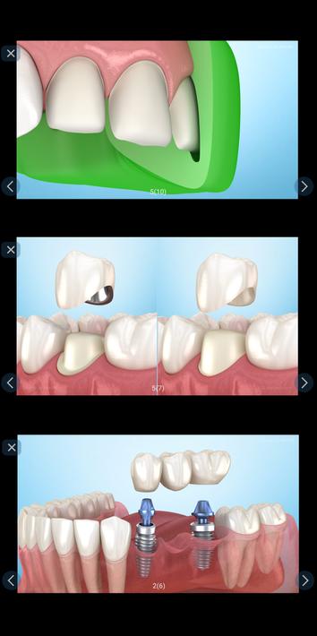 Dental 3D Illustrations