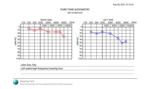 Hearing Test