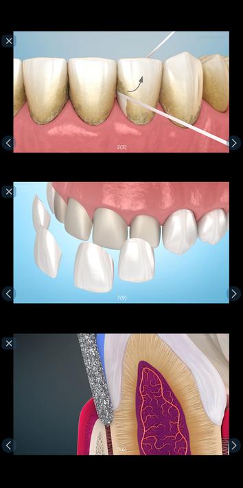 Dental 3D Illustrations