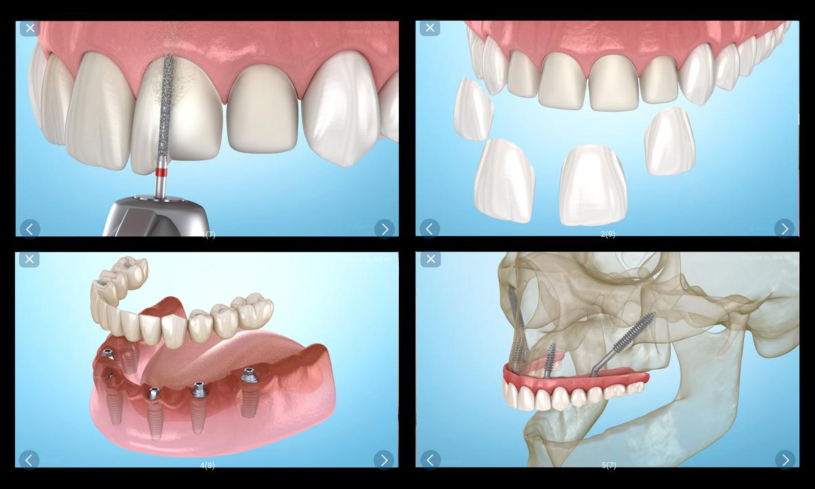 Dental 3D Illustrations