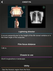 RX - Radiographic Positioning