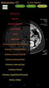 Radiology CT Anatomy